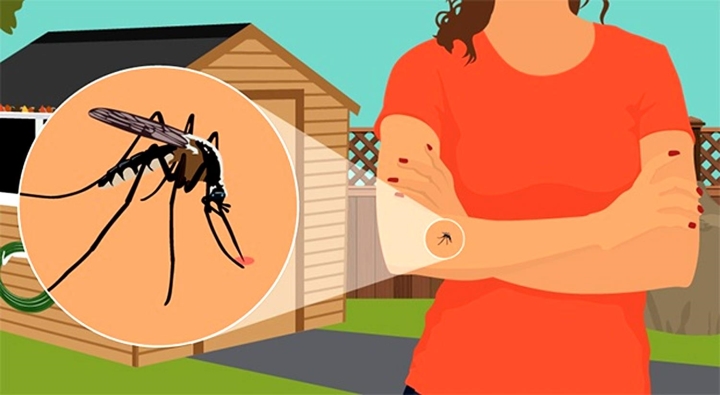 Tìm hiểu 6 cách chống muỗi đốt cực kỳ đơn giản